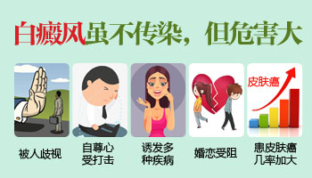 预防护理-护理白癜风哪些方法好啊-